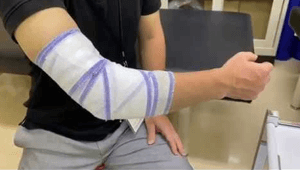 肘関節の固定法Youtubeのサムネイル